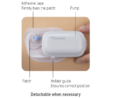 https://www.terumo-europe.com/Product%20Images/Detachable%20when%20necessary.png